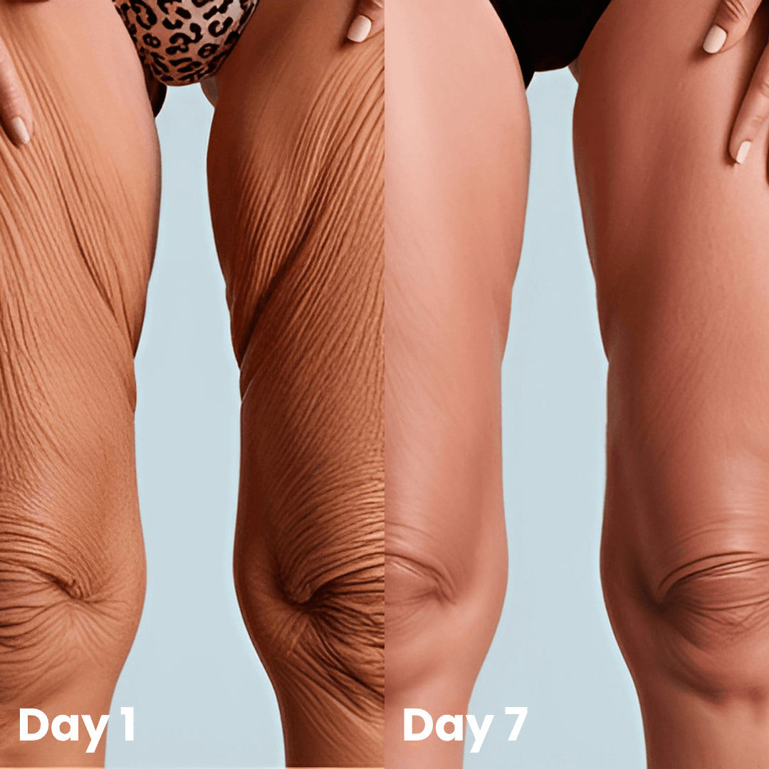 Noticeable wrinkle reduction in just 2 days.