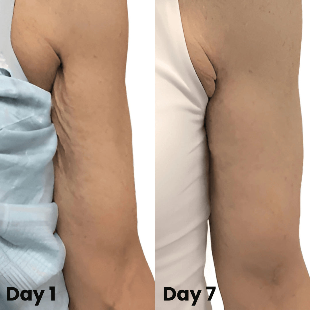 Body oils can be up to 10 times more effective than creams.